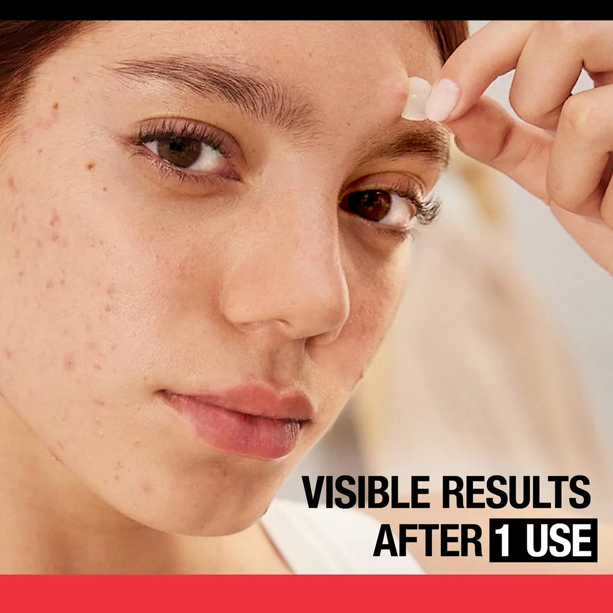 Parches Para Acné Y Espinillas Neutrogena Stubborn Acne Ultra-Thin Blemish Patches