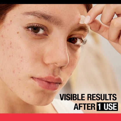 Parches Para Acné Y Espinillas Neutrogena Stubborn Acne Ultra-Thin Blemish Patches